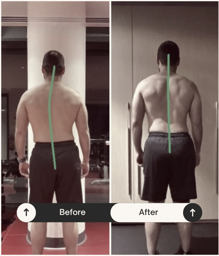 before after 2