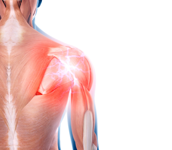 myofacial pain 2